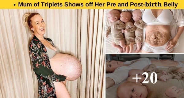 PRE AND POST SHOW OFF PICS OF PREGNANCYOF TRIPLET MOMMY