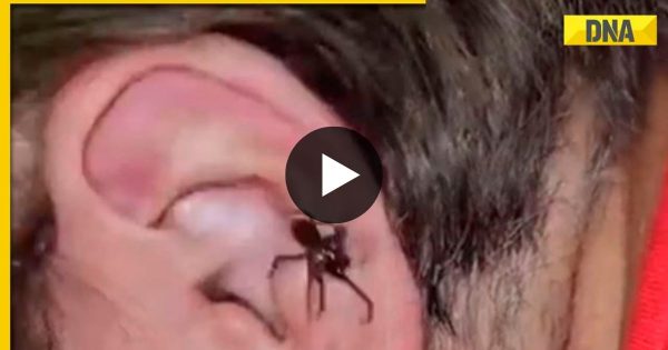 Big spider came out of man’s ear, people in panic due to viral video